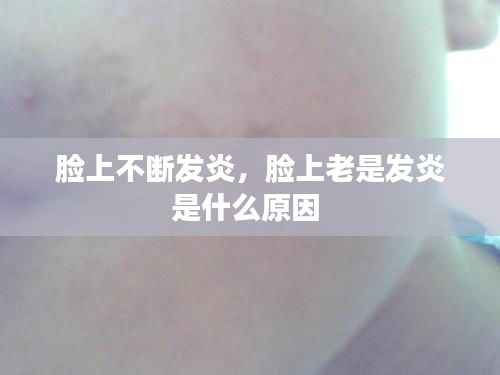 饭来张口 第3页