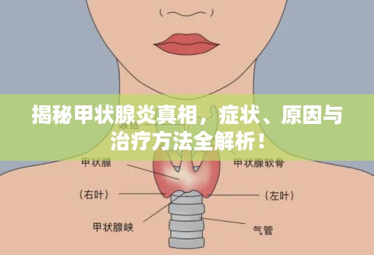 揭秘甲状腺炎真相,症状、原因与治疗方法全解析!